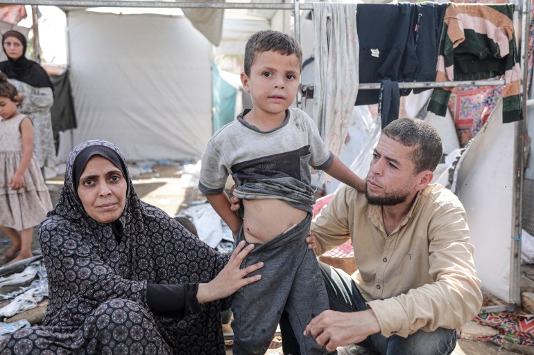 Madi shows the wound on her son Ahmed's stomach where shrapnel entered but doctors were not able to remove it because Gaza medical facilities have been decimated by Israel