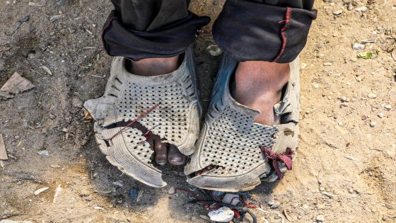 Gaza parents’ heartbreak as children’s clothes, shoes fall to pieces | Israel-Palestine conflict