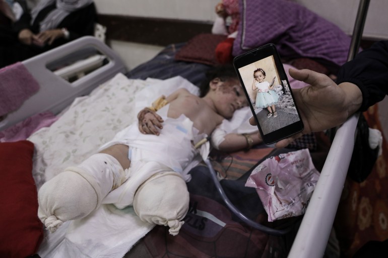 A hand holds a mobile showing Hanan before the Israeli bombs destroyed her legs. In a hospital in Deir el-Balah, Gaza